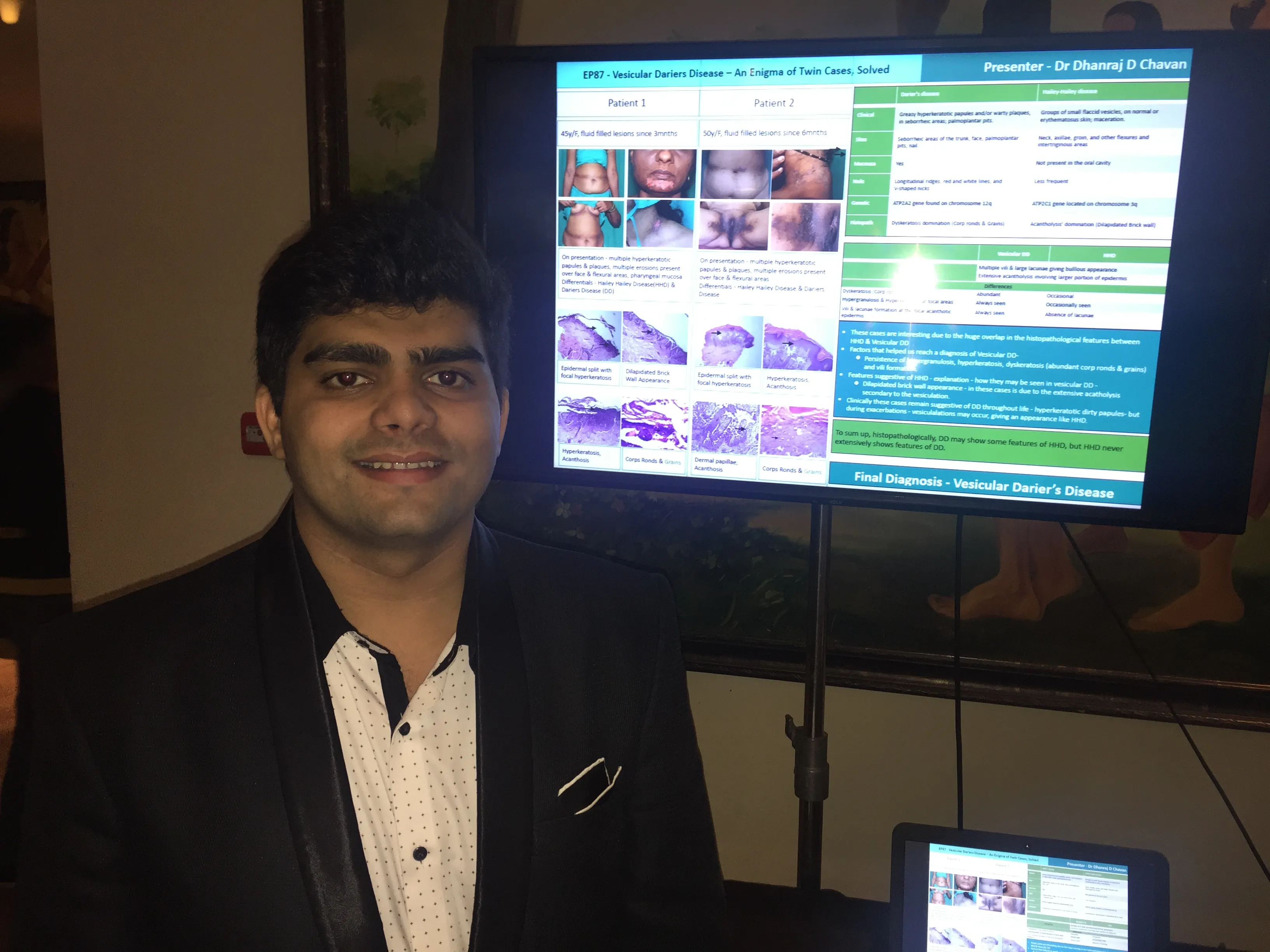 Dhanraj beside the Vesicular Darier's Disease poster — World Congress of Dermatology, Milan, June 2019