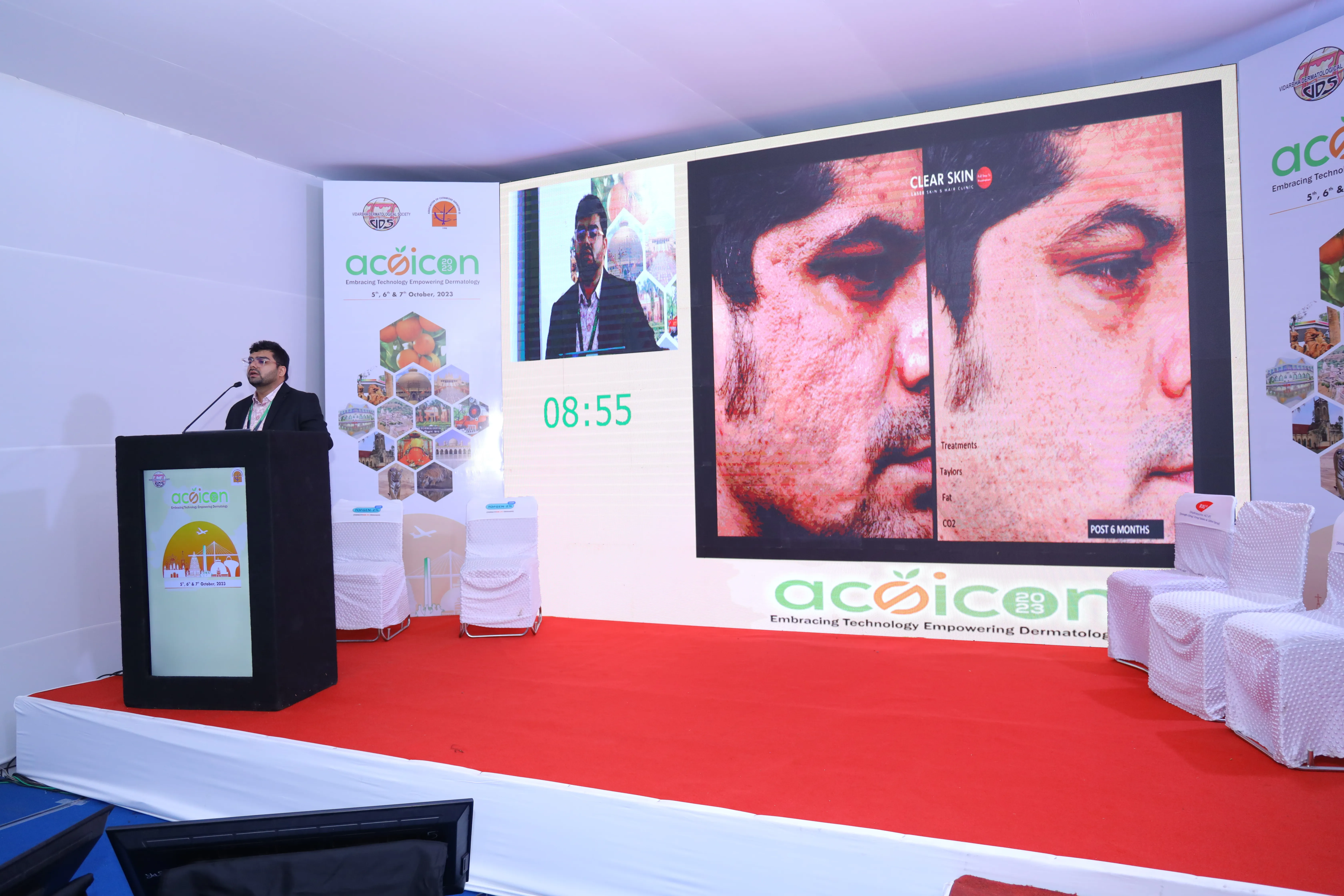 ACOICON 2023 podium - acne-scar before/after slide